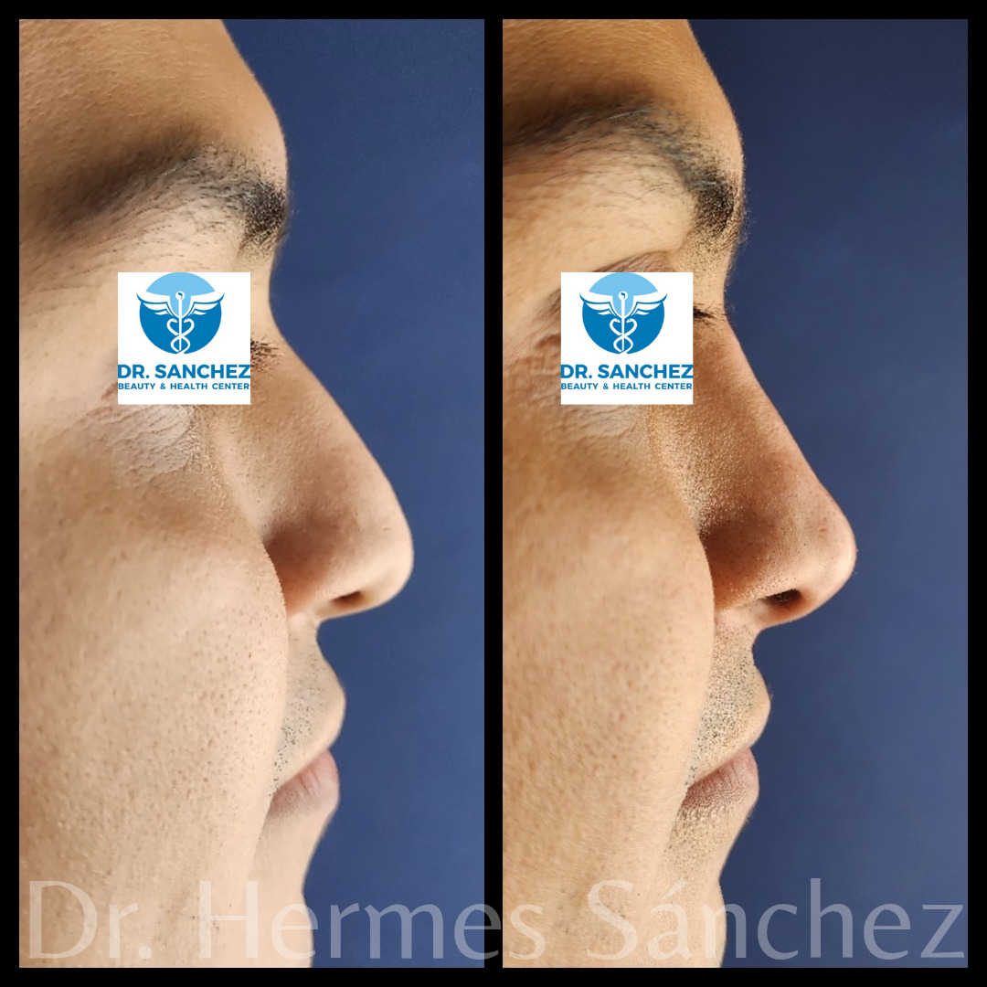 Galería - Transformación 3